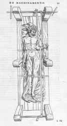 Réduction des fractures : un homme est fixé sur une civière, son bras cassé est étiré entre les deux axes. Planche illustrée de "De dissectione partium corporis humani libri tres..." par Carlo Stefano Riverio, Paris 1545