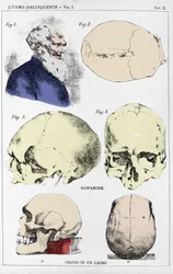 Étude sur la morphologie d