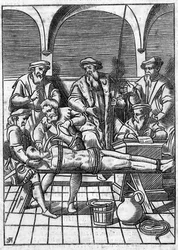 Torture au Moyen Âge : la question de l