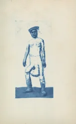 Éléphantiasis, c. 1870 (photo)