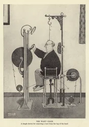 La chaise à verrue, un dispositif simple pour enlever une verrue du sommet de la tête