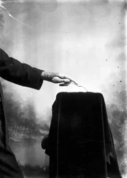 Prothèses Homme portant une main prothétique